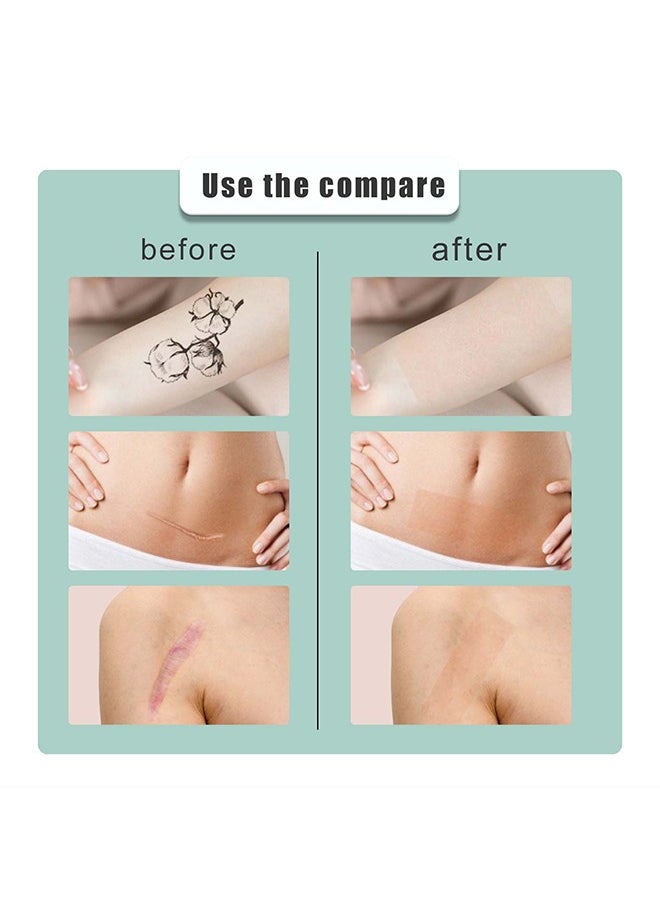 SOUTH MOON Complexion Concealer Patches - Skin Scar Tattoos Acne Scar Patches - Waterproof Complexion Patches  - Image 5
