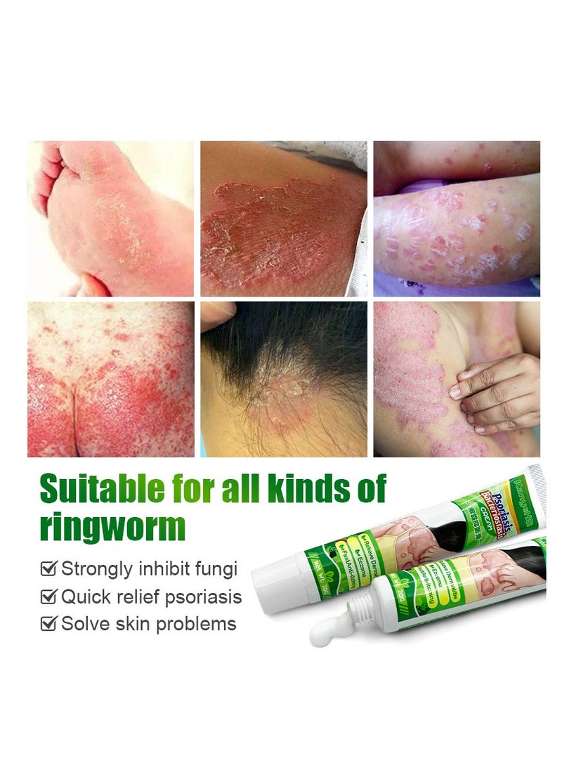 KanyeHB - Fast Itch Relief Cream – Gentle Care for Sensitive Skin - Image 1
