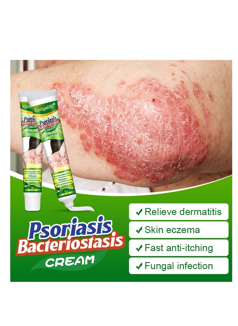 KanyeHB - Fast Itch Relief Cream – Gentle Care for Sensitive Skin - Image 1