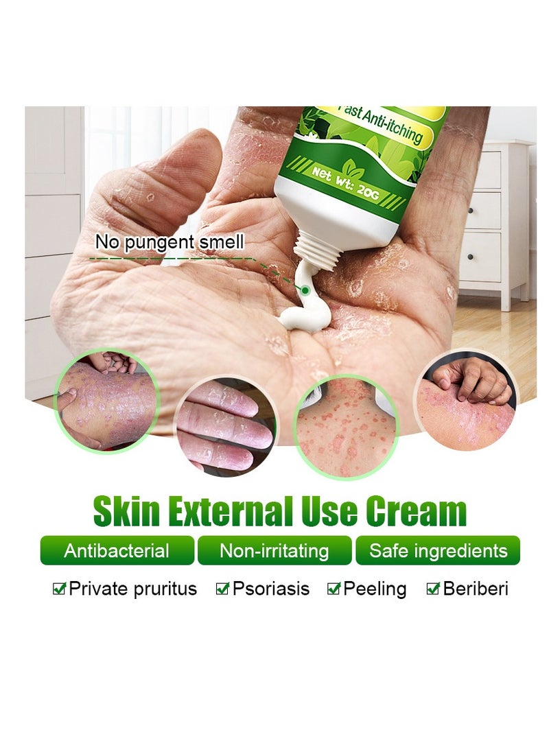 KanyeHB - Fast Itch Relief Cream – Gentle Care for Sensitive Skin - Image 1