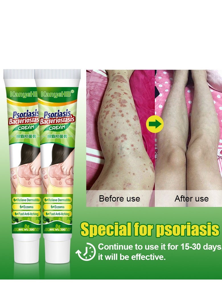 KanyeHB - Fast Itch Relief Cream – Gentle Care for Sensitive Skin - Image 1