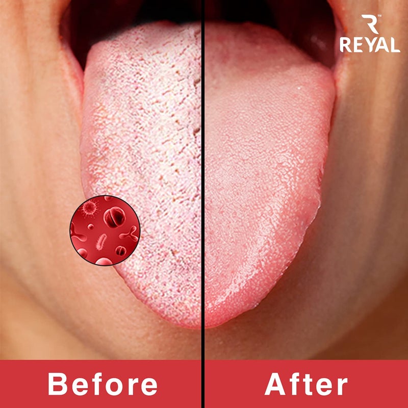 Reyal Pure Copper Tongue Cleaner, Fights Bad Breath, 100% Copper Ayurveda Tongue Cleaner for Adults and Kids(Pack of 2) - Image 5