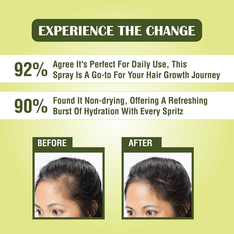 MYHERB Rosemary Water Hair Spray 200 Ml 100 Pure Natural And Originol Rosemary Hair Mist Hair Spray For RegrowthHelps Reduce HairfallStrengthens Hair Suitable For All Hair Types - Image 4