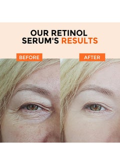 +1HEROLABS Retinol Serum for Face 2.5%, B5 Resurfacing Retinol Serum with Vitamin C, Vitamin E, Hyaluronic Acid, Niacinamide, Serum for Anti-Aging, Wrinkle Smoothing, Dark Spot Corrector, Brighten Dullness  - Image 5
