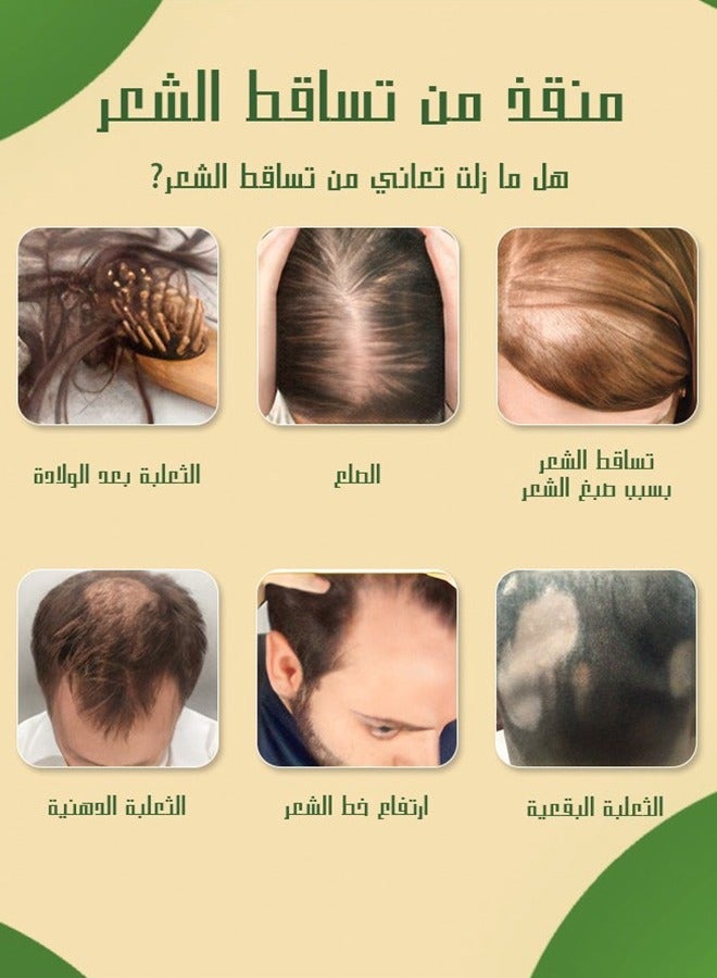 MEJISOO Rosemary And Batana,Blend Hair Growth Oil - Rosemary Oil with Batana Essential Oil for Hair Care- Dry Damaged Hair and Growth, Hair Loss Scalp Treatment, Healthier Thicker Fuller Hair, 30ml - Image 3