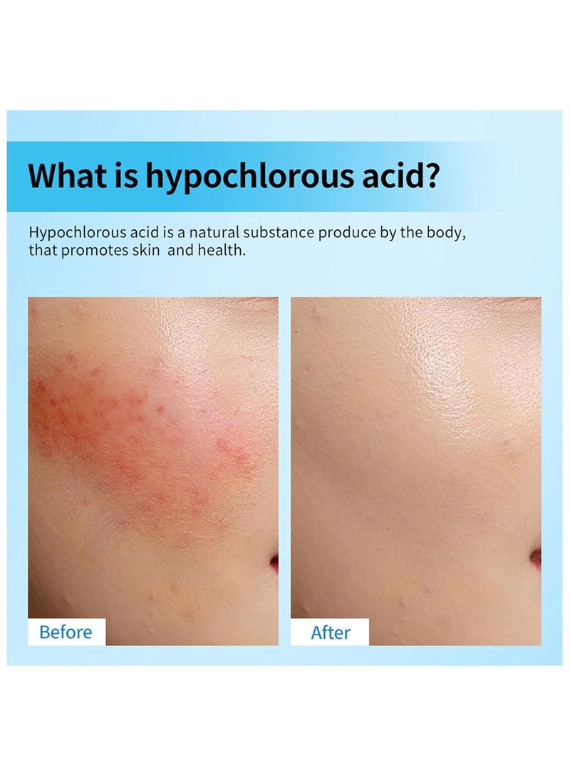 lakerain Hypochlorous Acid Spray for Face and Skin, Non-Irritating Hypochlorous Acid Spray & Eyelid Cleanser Solution to Remove Oil & Debris, Acne, Piercing Aftercare, Calm Redness, 2.2 fl oz - Image 3