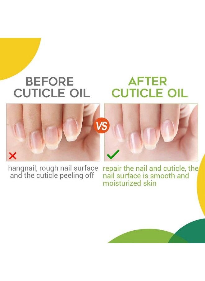 modelones - Cuticle Oil 15Ml Nail & Cuticle Care Strengthener Oil Vitamin E + B Fragrancefree Cuticle Revitalizing Oil For Nail Growth And Gel Nail Polish - Image 1