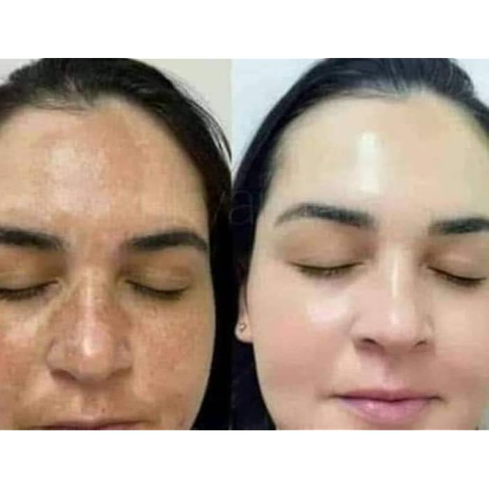 نتائج الطبيعه كريم تفتيح البشره 3 كيس حجم الكيس 35 جرام - Image 3