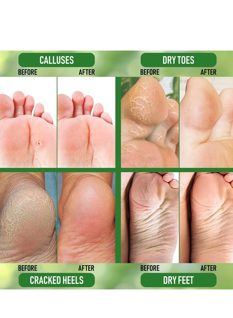 EELHOE Allantoin 40% cream for cracked rough thick and dry skin soothes and softens feet , elbows and knees - Image 4