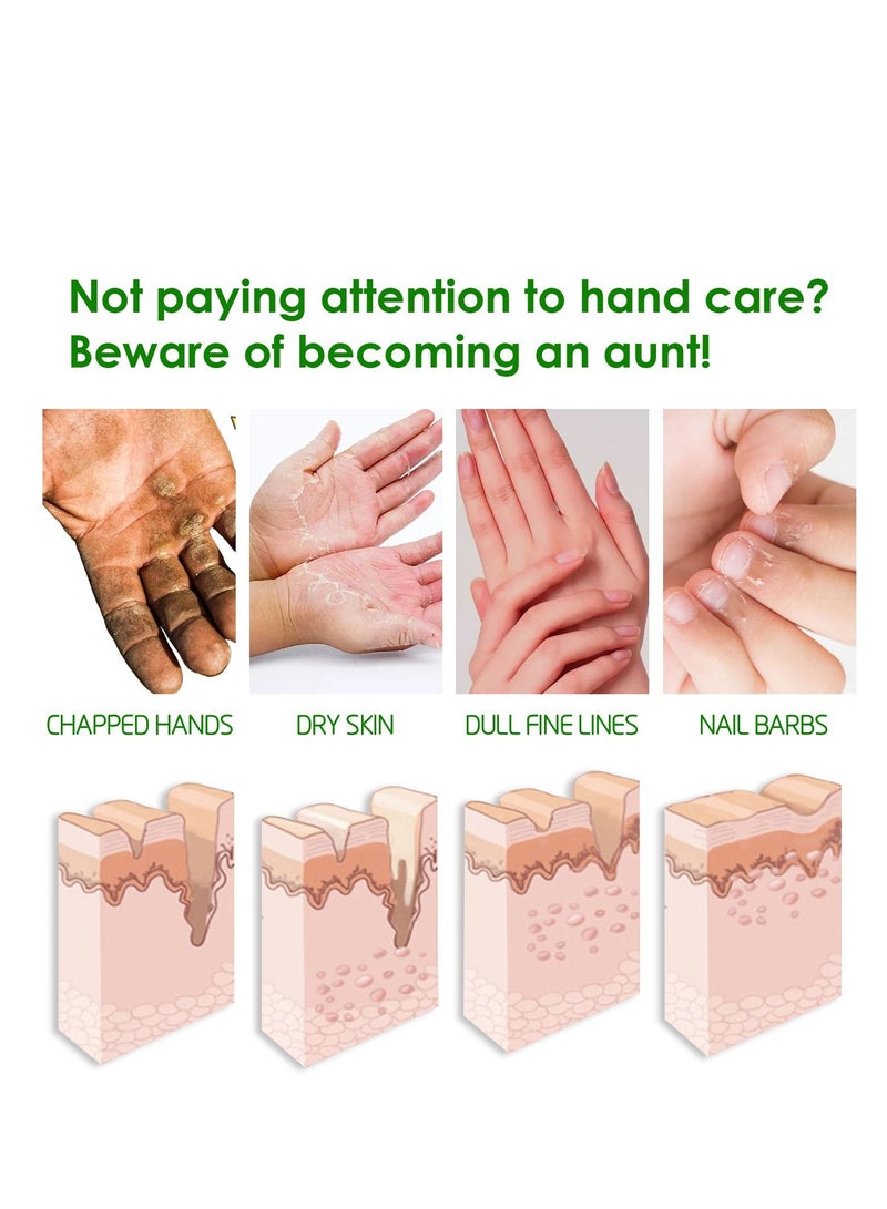 EELHOE Allantoin 40% cream for cracked rough thick and dry skin soothes and softens feet , elbows and knees - Image 3