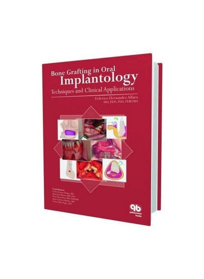 Bone Grafting in Oral Implantology: Techniques and Clinical Applications