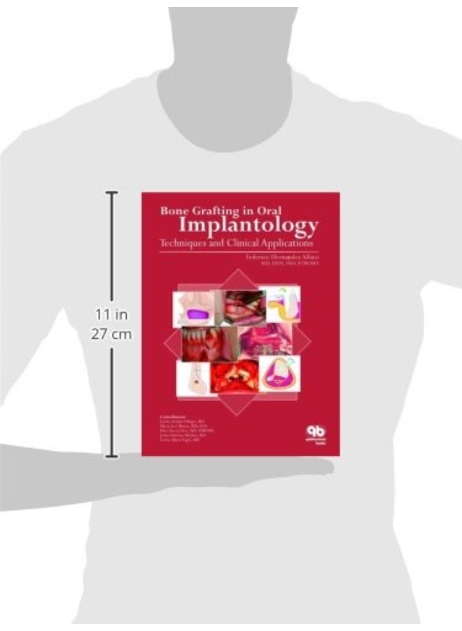 Bone Grafting in Oral Implantology: Techniques and Clinical Applications