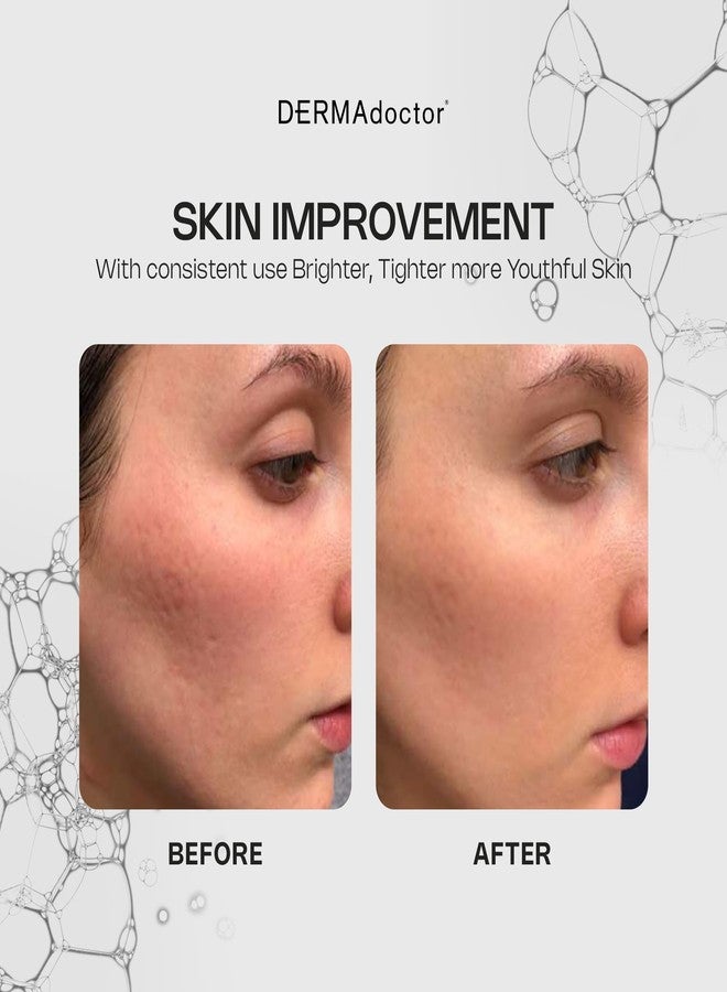 DERMAdoctor Vitamin C Face Serum 20% Vitamin C, Vitamin-E, Ferulic Acid, Ascorbic Acid Concentrated Dermatologist-Formulated Anti-Aging, Hydrating & Discoloration Correcting Serum for Face -1.0 fl oz - Image 3