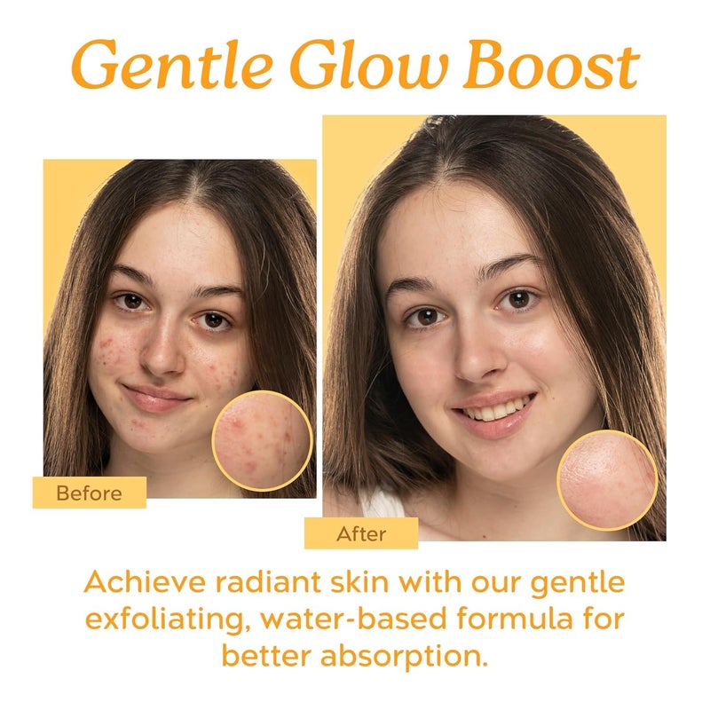 Tree To Tub Mandelic Acid Serum 10 Gentle Exfoliating AHA Serum wLactic Glycolic Acid for Smoother Skin Hyaluronic Acid to Hydrate Vegan Skincare for Men Women - Image 2