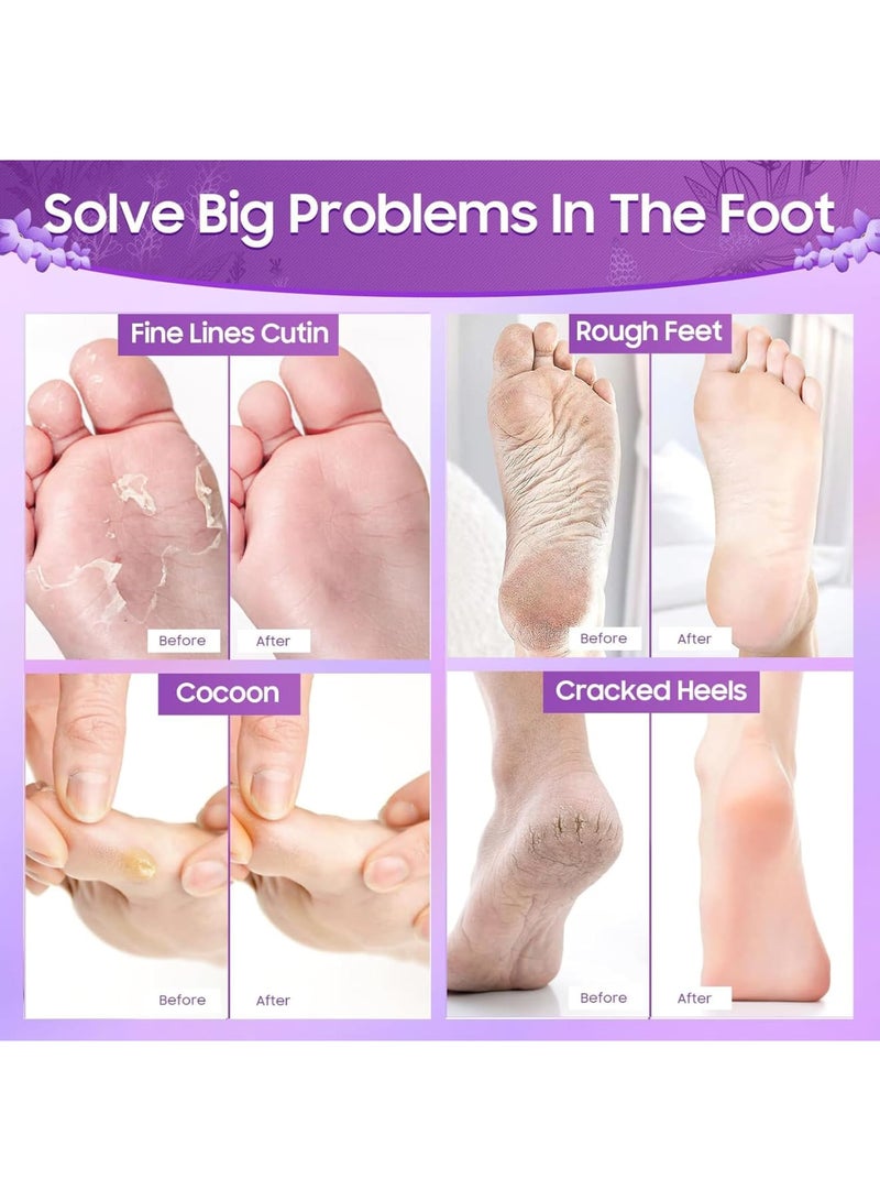 SOLARAE قناع تقشير القدم، 4 أزواج من أقنعة القدم المقشرة، مقشر طبيعي للجلد الجاف الميت، مسمار القدم، إصلاح الكعوب الخشنة، رعاية صحية أكثر للقدمين للرجال والنساء - Image 5