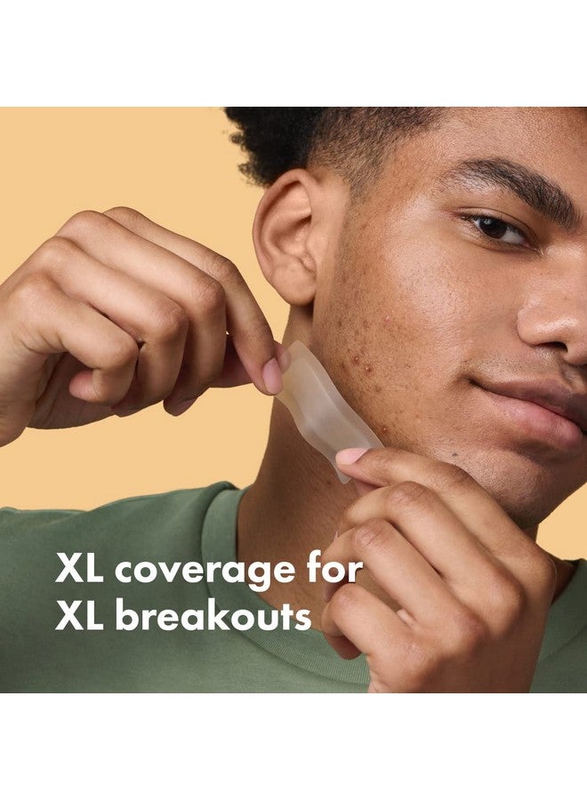 مايتي باتش رقعة سطحية قوية من هيرو كوزماتيكس - رقعة هيدروكولويد موضعية للجسم والخدود والجبهة والذقن، مناسبة للنباتيين (10 قطع) - Image 2