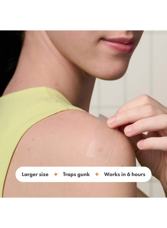 مايتي باتش رقعة سطحية قوية من هيرو كوزماتيكس - رقعة هيدروكولويد موضعية للجسم والخدود والجبهة والذقن، مناسبة للنباتيين (10 قطع) - Image 3