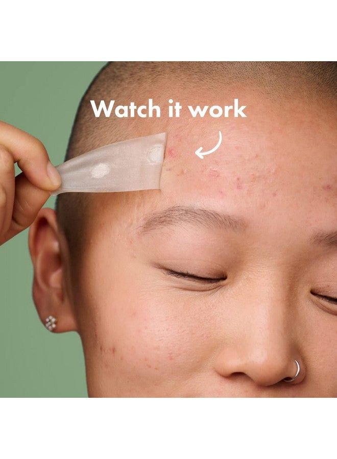 مايتي باتش رقعة سطحية قوية من هيرو كوزماتيكس - رقعة هيدروكولويد موضعية للجسم والخدود والجبهة والذقن، مناسبة للنباتيين (10 قطع) - Image 4