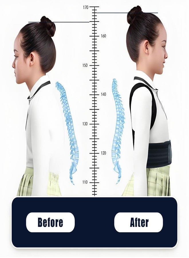 Flylin Posture Corrector for Kids Adjustable Back Straighter with Shoulder Pads Upper Back Posture Brace for Teenagers to Provide Spinal Support Improve Posture and Prevent Slouching (Small, waist size 15.7-23.6in) - Image 2
