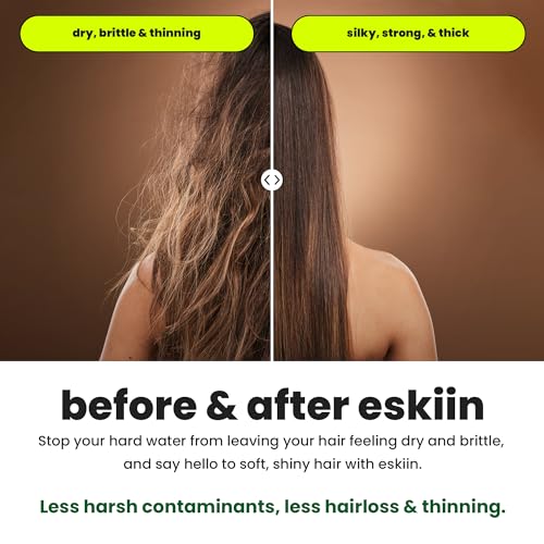 Eskiin Filtered Showerhead - Best Shower Head With Filters For Healthy Hair & Skin - High Pressure Water Softener For Hard Water - Reduce Dandruff, Protect Colored Hair, And Soothe Dry Skin (Black) - Image 5