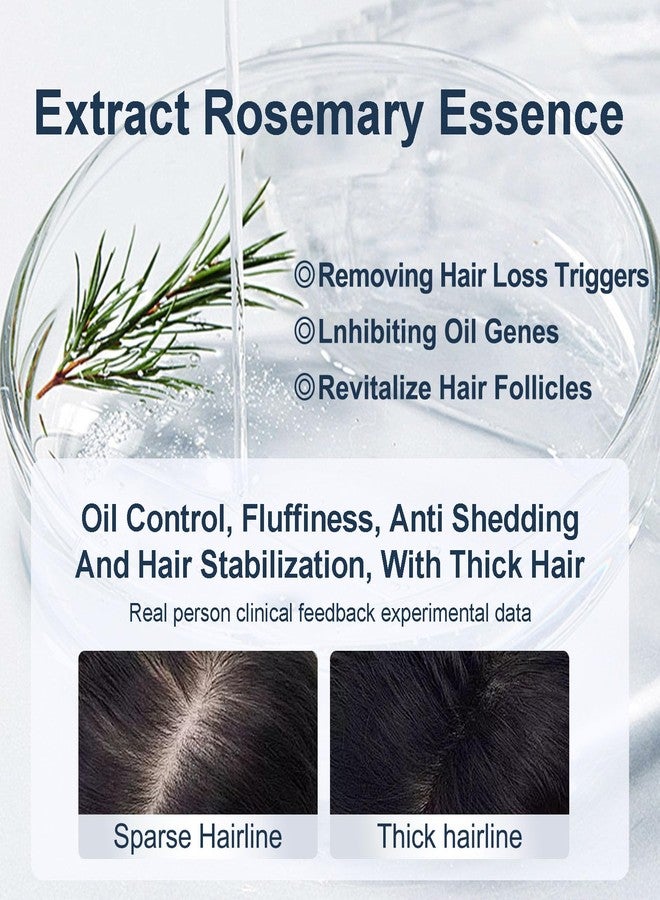 Tgideas Organic Biotin & Rosemary Hair Growth Shampoo – Thickening Shampoo with Amino Acids for Hair Loss, Dandruff Control & Oily Scalp - for Women & Men - Image 3