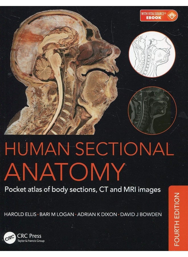 Human Sectional Anatomy: Pocket atlas of body sections, CT and MRI images, Fourth edition 
