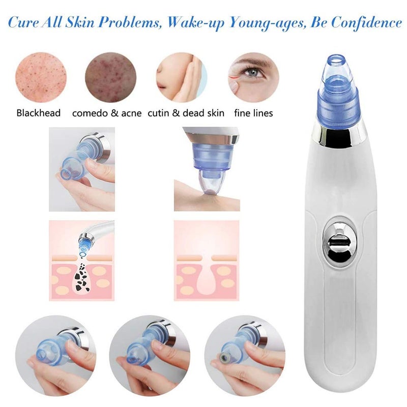 Plenteous Blackhead Whitehead Extractor Remover Device Acne Pimple Pore Cleaner Vacuum Suction Tool For Men And Women - Image 2