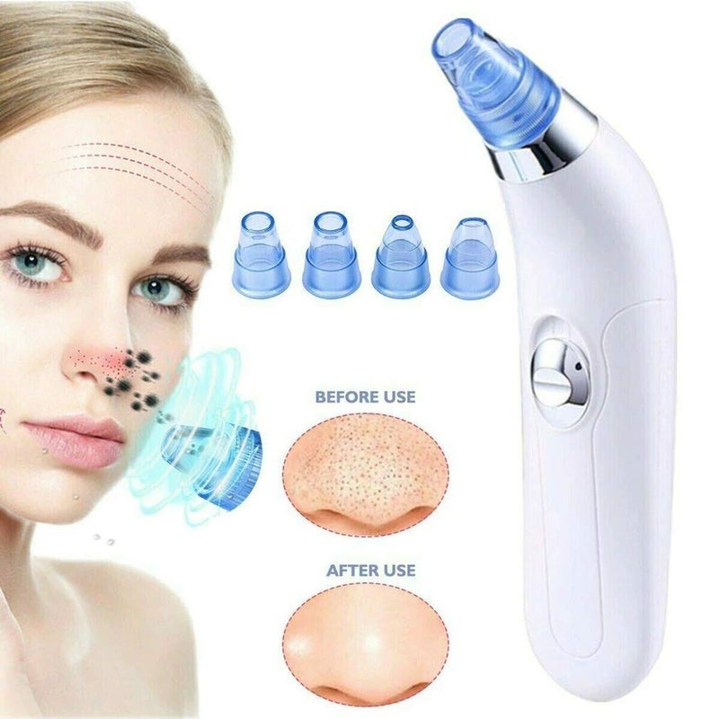 Plenteous Blackhead Whitehead Extractor Remover Device Acne Pimple Pore Cleaner Vacuum Suction Tool For Men And Women - Image 4