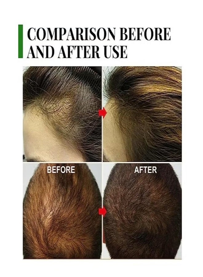 EELHOE Rosemary Hair Growth Essential Oil Fast Growing Anti Hair Loss 30m - Image 2