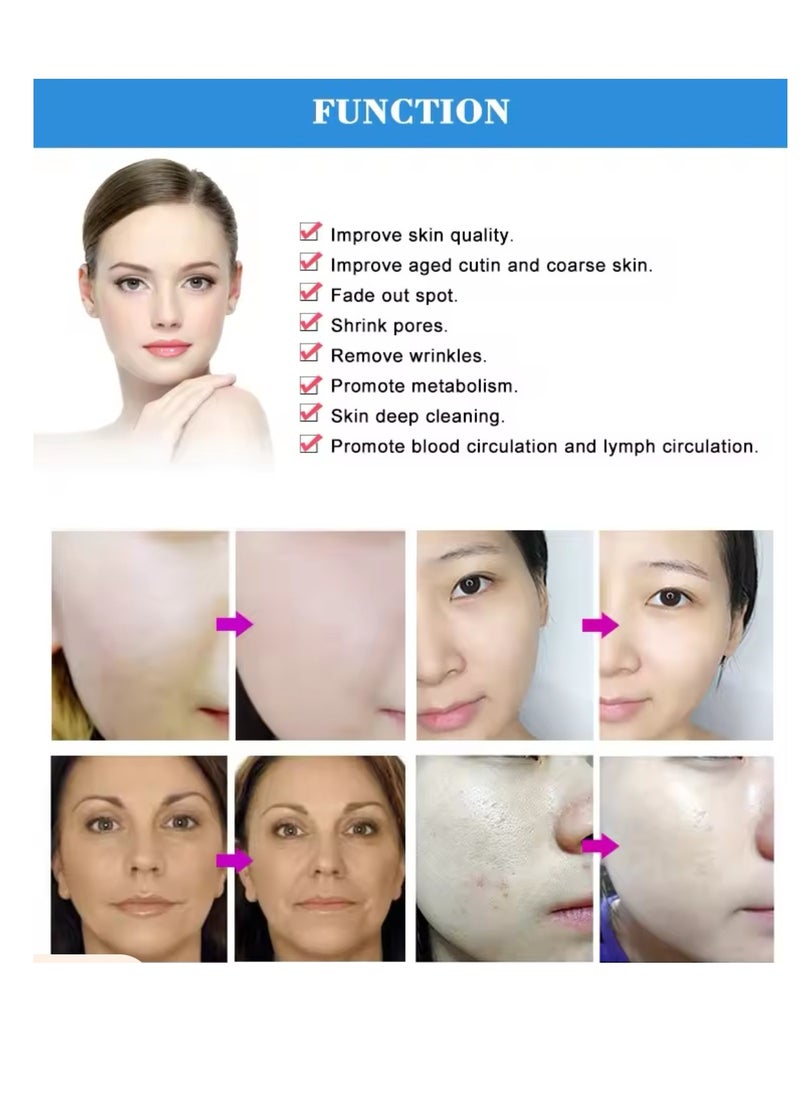 Diamond peeling - diamond peel device - Image 1