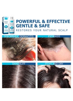 Roycederm Roycederm Psoriasis Shampoo, Seborrheic Dermatitis Shampoo, Folliculitis Shampoo, Dandruff Shampoo, Scalp Psoriasis & Seborrheic Dermatitis Treatment, Dry Itchy Scalp Treatment  - Image 5