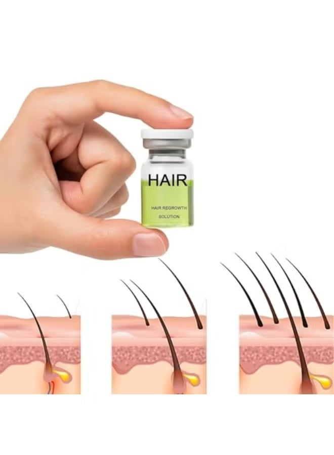 Solution 2-BOX Microneedle Hair, Alphainfuse Hair Regrowth System, Advanced Hair Growth Treatment Serum for Thicker, Fuller Hairs, Strengthens Roots, Gentle Painless, Supports Healthy Hairs Growth for Men & Women (2Pcs) - Image 5