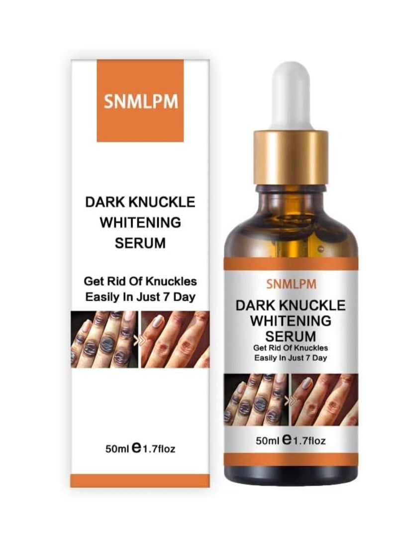 SNMLPM مصل تبييض المفاصل الداكنة علاج 7 أيام للبقع الداكنة في اليد والقدمين، تقشير مفاصل اليد والقدمين يحسن البهتان، تأثير تبييض قوي للرجال والنساء، 50 مل  - Image 1