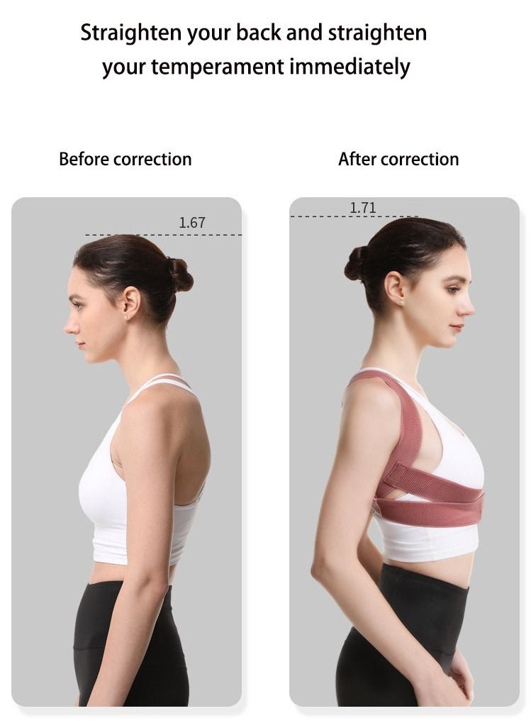 JSDUN - Posture Corrector Back Corrector for Neck, Back and Shoulders Correct Anti Hump Corrector Orthopedic Bra for Scoliosis Kyphosis Back Splint Red, M - Image 1