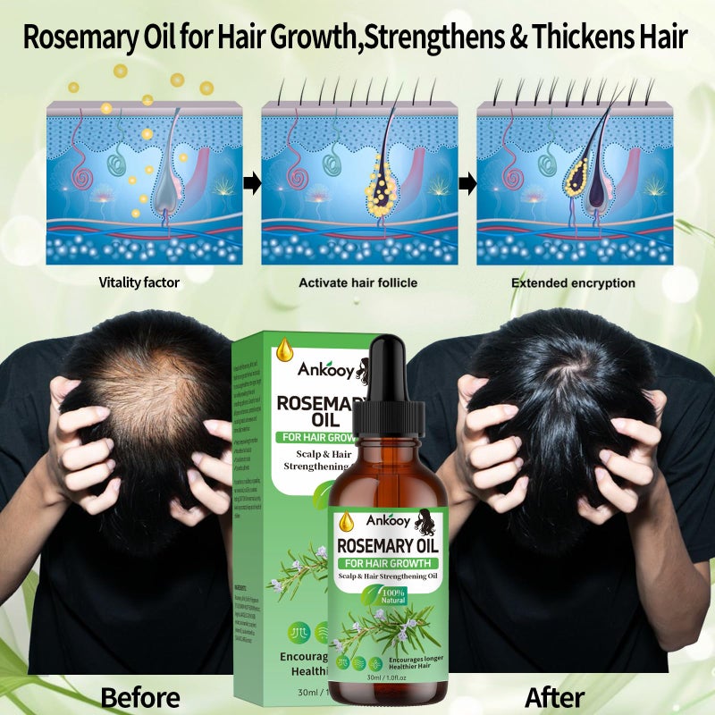 Ankooy 3 Pack Rosemary Oil for Hair Growth,Rosemary Hair Growth Oil,Strengthening Oil for Dry Damaged Hair,Hair Loss Treatment & Thickens Hair,Scalp Care Promotes Hair Thickness for Men Women - Image 4