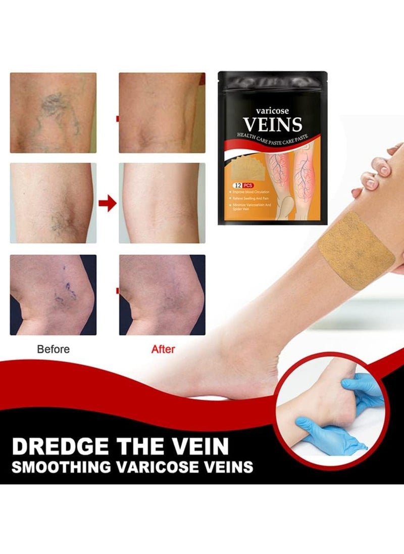 Generic 12 Pcs Varicose vein patch for leg health,Varicose vein patch for pain relief,blood circulation,Swelling,Spider veins  - Image 4
