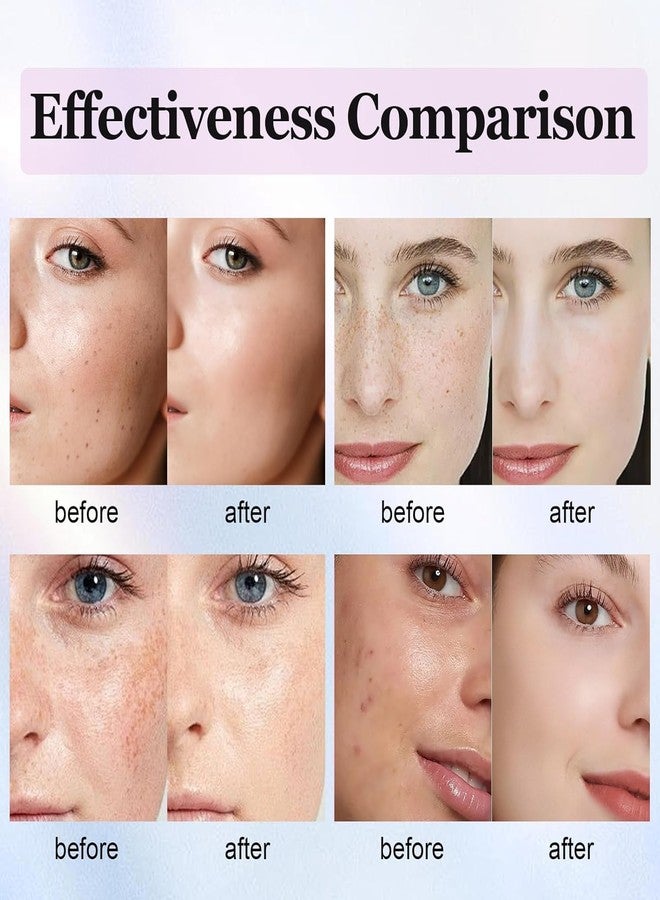 POBEMY Dark Spot Remover for Face Body, Dark Spot Corrector Cream for Sun Spots, Age Spots, Brown Spots, Melasma Natural Dark Spot Remover Skin Care with Niacinamide Vitamin C for Women (1.1 Fl Oz) - Image 5