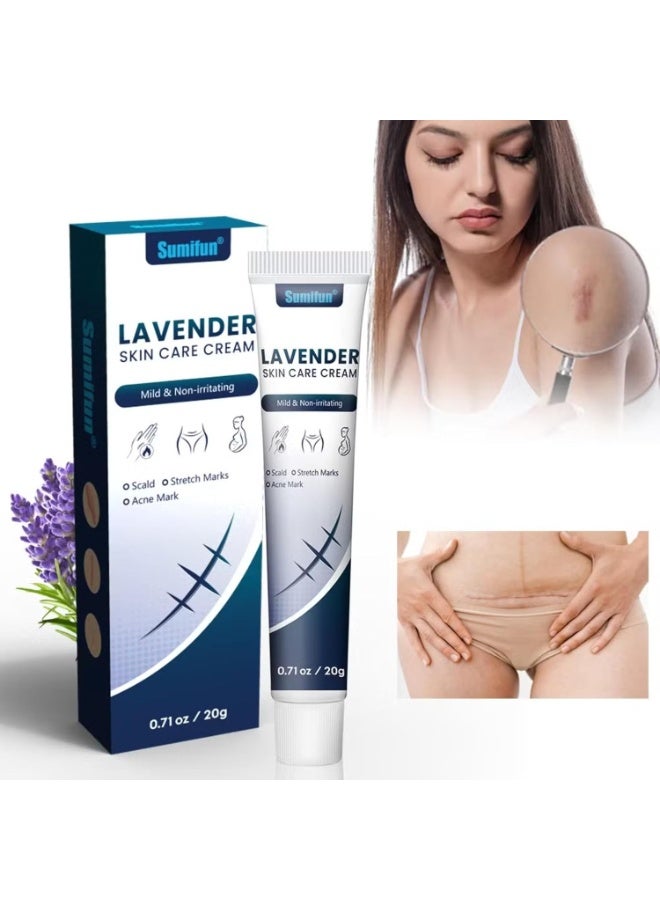 سوميفون كريم إزالة الندبات 20 جم ، كريم العناية بالبشرة من اللافندر ، كريمات إصلاح الندبات للحروق الحروق علامات التمدد ندبات حب الشباب والندبات القديمة تسريب اللافندر المهدئ لاستعادة الجلد - Image 2