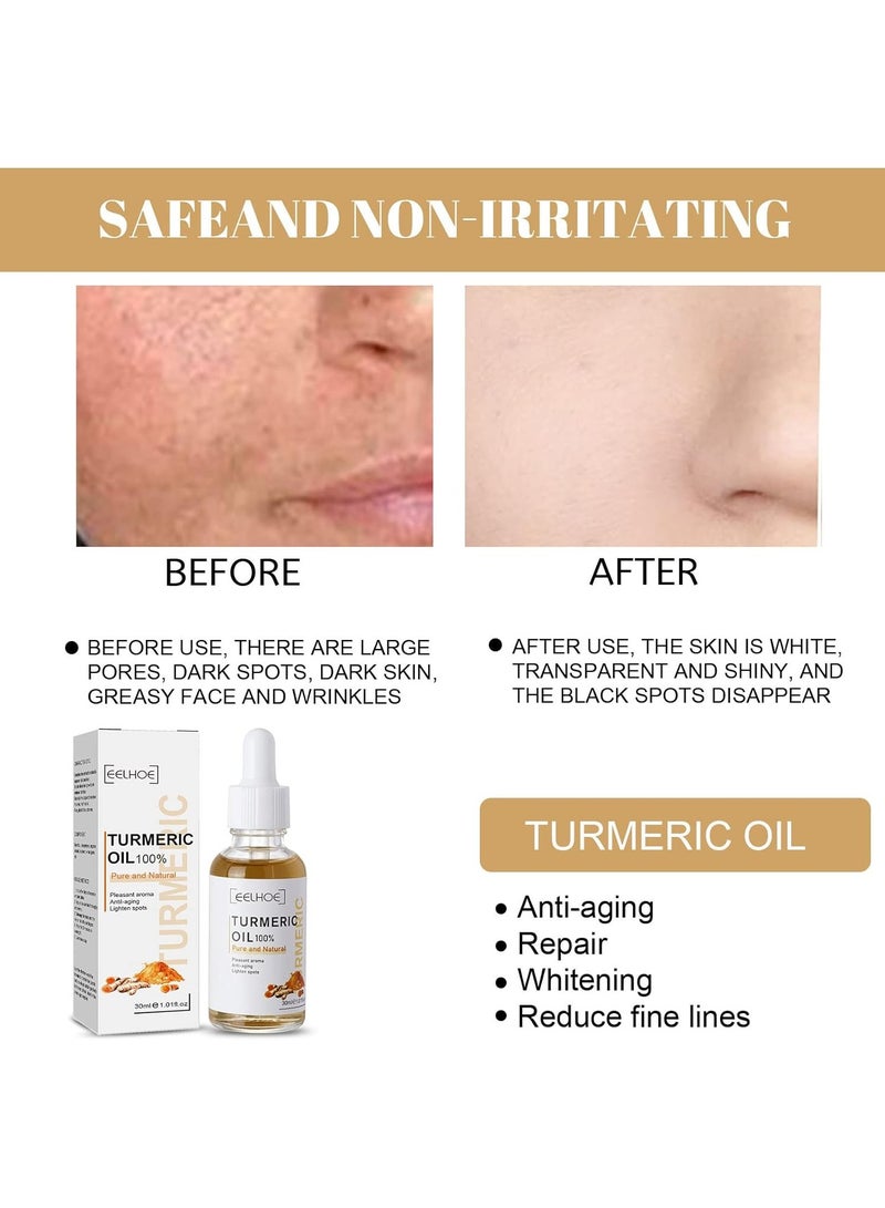 EELHOE Turmeric Dark Spot Corrector Serum, 2022 New Natural Turmeric Repair Face Serum, Facial Moisturizing Essence, Bright Skin Dark Spot Corrector Face Whitening Serum - Image 3