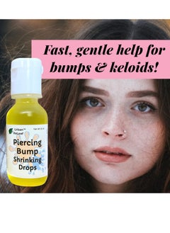 Urban ReLeaf Urban ReLeaf Piercing Bump Shrinking Drops! Keloid Bumps Gentle Effective Aftercare Solution. Natural Essential Oils. Fast Removal Help for Scars Nodules Cartilage Nose Ear Spots. Clean Soothe  - Image 2