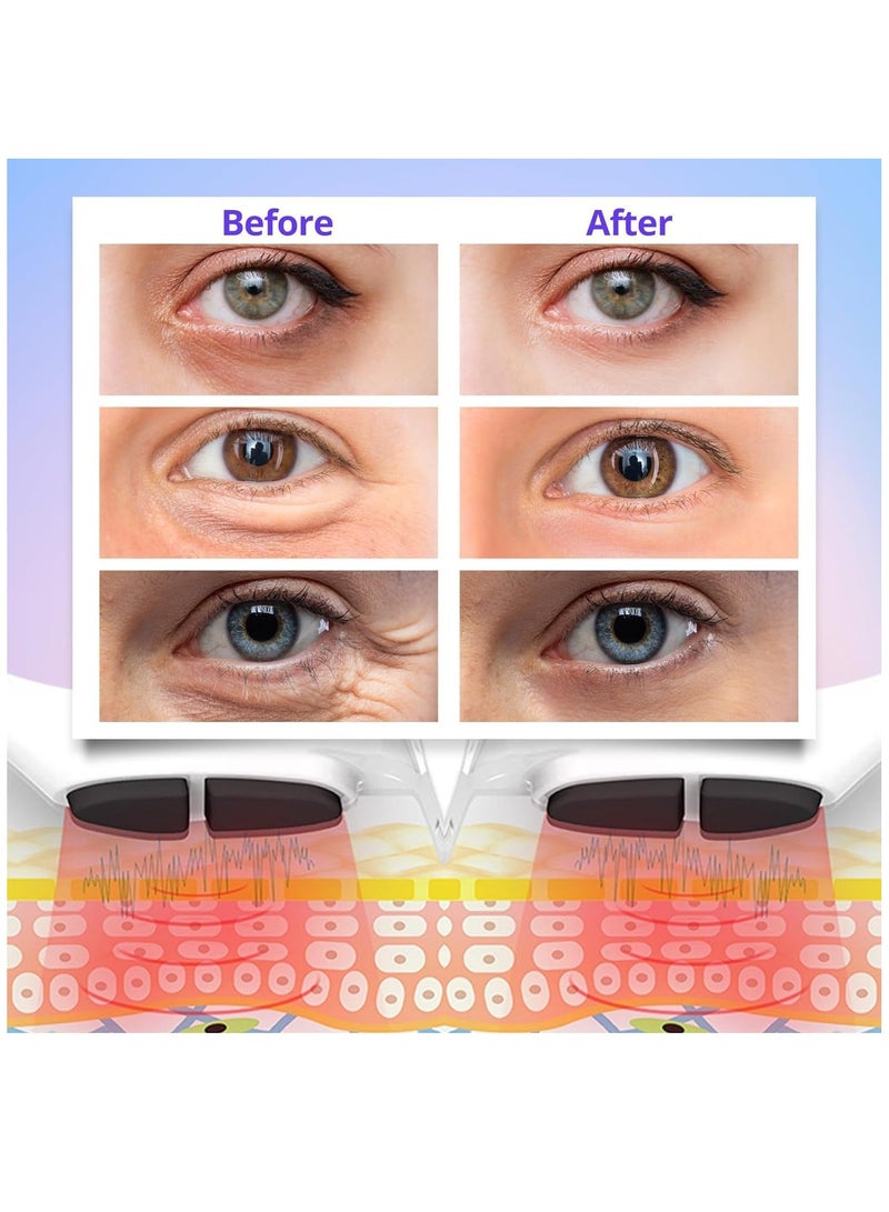 Generic 3D Eye Beauty Massager for Dark Circles Eye Bags, Deep Repair Massager Relax Eye Strain Home Use Eye Beauty Care Machine has 3 Modes of Low, Medium and High - Image 5