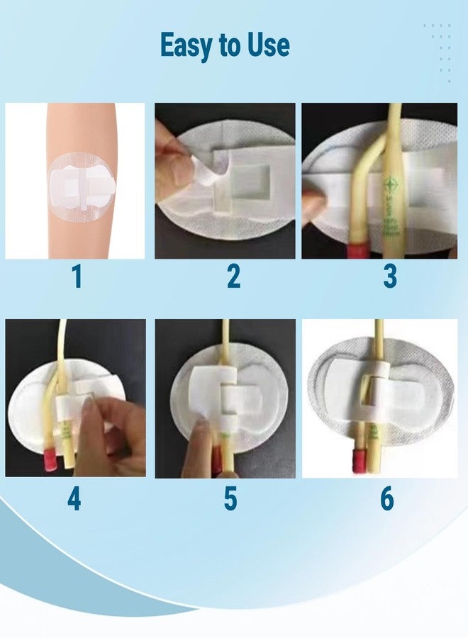 Lnrueg 40 PCS Catheter Stabilization Devices, Catheter Stickers for Foley Bag Holder, Leg Band Urinary Stabilizer Adhesive Sticker Patch Accessories, Foley Catheter Leg Anchor Bandages (40PCS) - Image 5