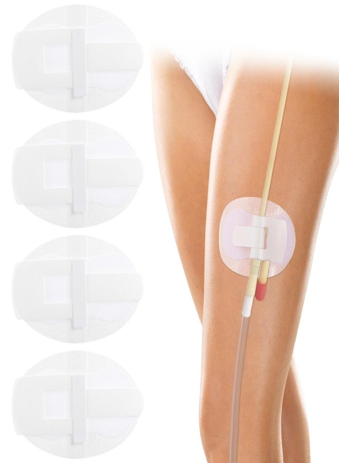 Lnrueg 40 PCS Catheter Stabilization Devices, Catheter Stickers for Foley Bag Holder, Leg Band Urinary Stabilizer Adhesive Sticker Patch Accessories, Foley Catheter Leg Anchor Bandages (40PCS) - Image 2