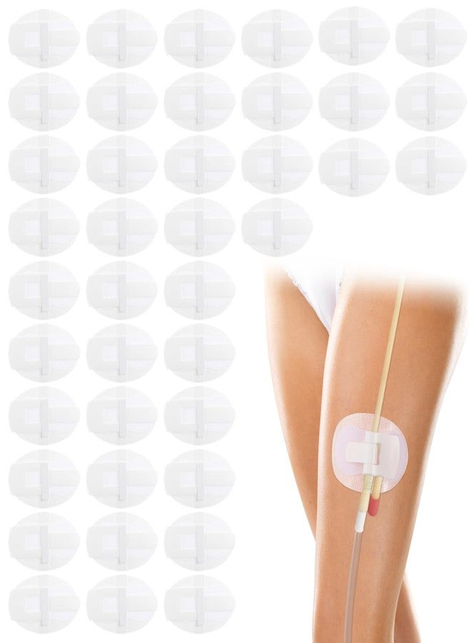 Lnrueg 40 PCS Catheter Stabilization Devices, Catheter Stickers for Foley Bag Holder, Leg Band Urinary Stabilizer Adhesive Sticker Patch Accessories, Foley Catheter Leg Anchor Bandages (40PCS) - Image 1