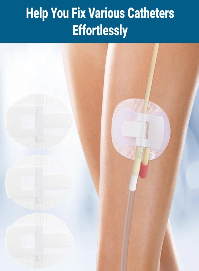 Lnrueg 40 PCS Catheter Stabilization Devices, Catheter Stickers for Foley Bag Holder, Leg Band Urinary Stabilizer Adhesive Sticker Patch Accessories, Foley Catheter Leg Anchor Bandages (40PCS) - Image 3