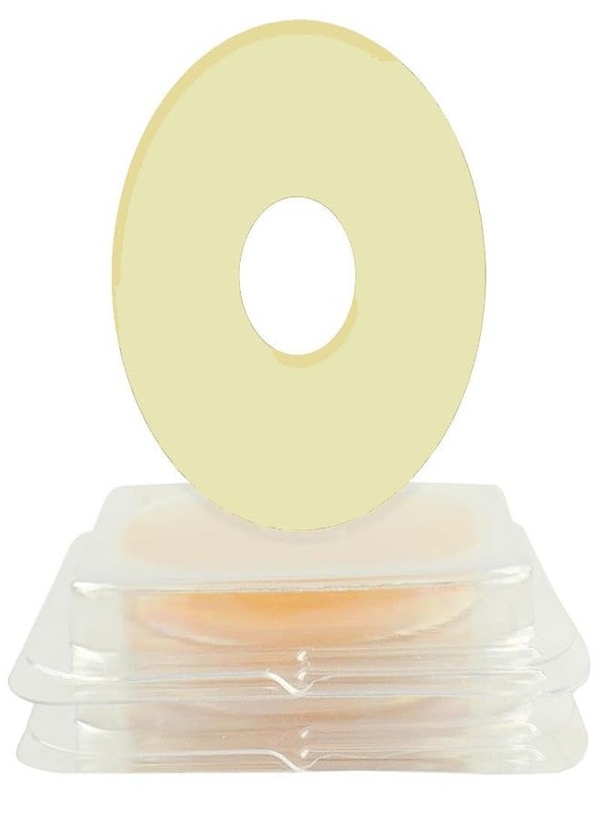 THUJPKU 20 PCS 2mm Ostomy Barrier Rings, Moldable Ostomy Supplies, Flexible Medical Grade Hydrocolloid Ostomy Bag Supplies, 2mm Thickness - Image 1