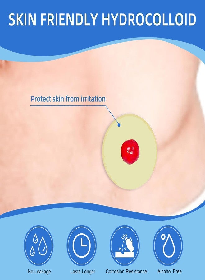 THUJPKU 20 PCS 2mm Ostomy Barrier Rings, Moldable Ostomy Supplies, Flexible Medical Grade Hydrocolloid Ostomy Bag Supplies, 2mm Thickness - Image 2