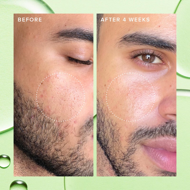 Farmacy 2% Salicylic Acid Toner for Face - Deep Sweep Gentle BHA Exfoliant for Oily Skin - Refines Texture with Papaya Enzymes & Moringa Water for a Healthy-Looking Complexion (50ml) - Image 5