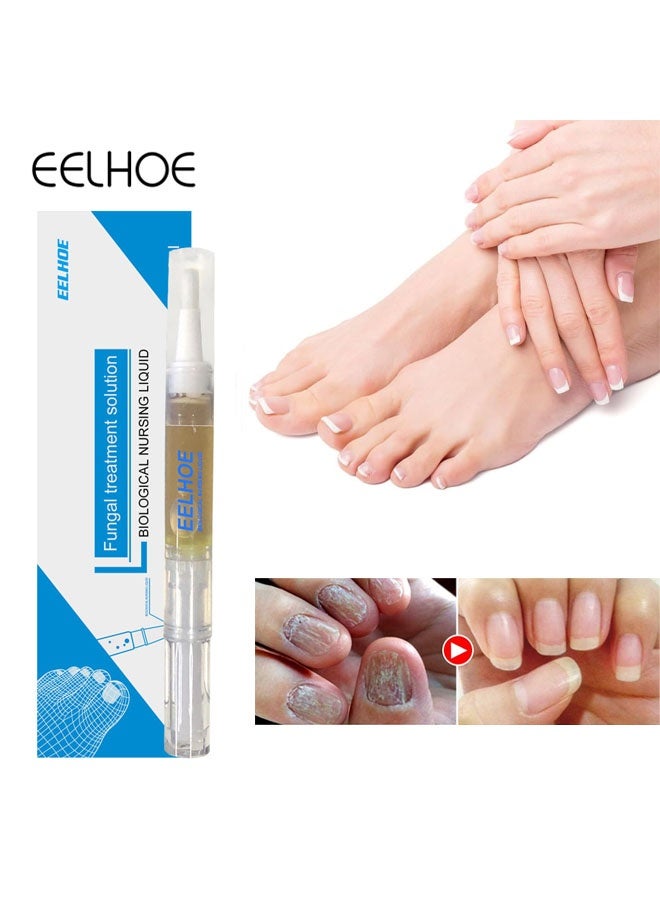 إيلهو محلول علاج فطري، قلم تصليح أظافر مضاد للفطريات، سائل عناية بفطريات الأظافر للعناية اليومية باليدين والقدمين، يرطب وينعم الأظافر السميكة، يصلح تلف الأظافر، 3 مل - Image 1