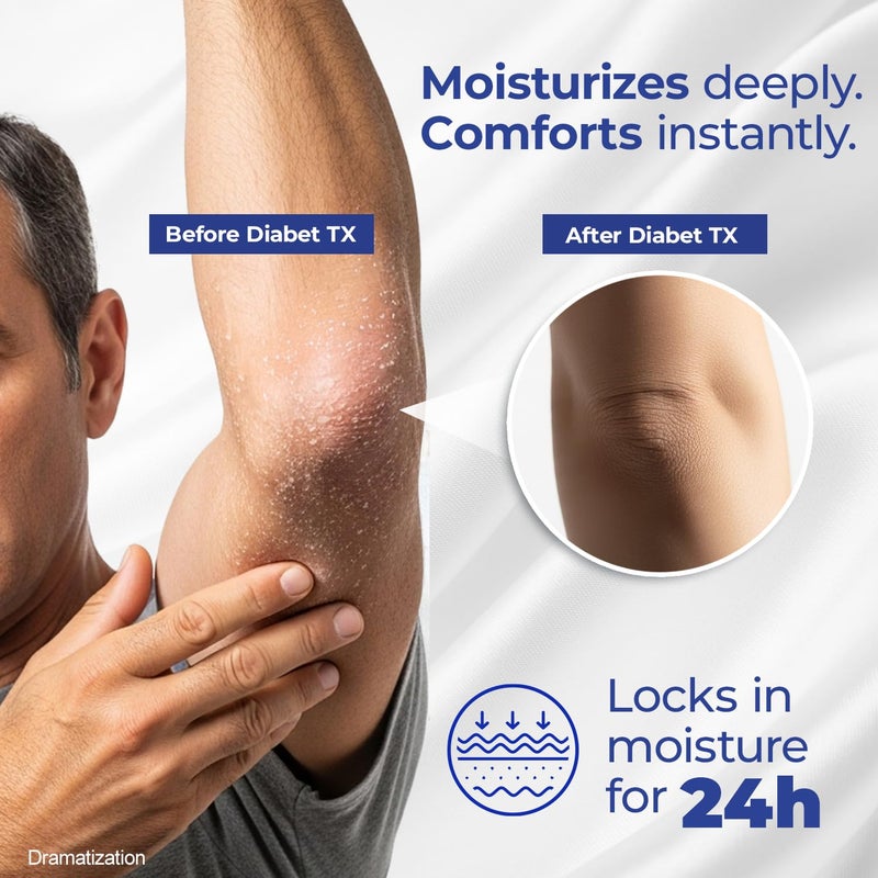 Goicoechea Diabet TX Diabetic Lotion with Urea for Dry Skin | Soothing Hydrating Cream with Aloe, Oatmeal & Vitamin E for Hands, Elbows, Feet & Body | Extra Dry Skin Support, 13.5 Oz | 1-Pack - Image 4